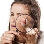 adult acne treatments and skin conditions