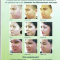 Dadashie Acne System – Help for Acne Skin