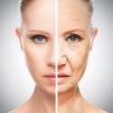 Hyperpigmentation – Facts, Tips & Treatments