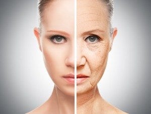 Hyeprpigmentation aging skin