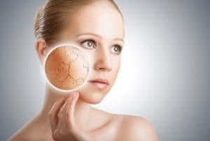 help for dry skin in Peoria